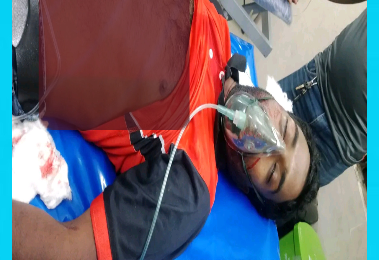 চৌগাছায় দাদির মরদেহ দেখতে এসে নাতির মৃত্যু, আহত ৩