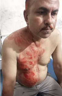 কেন্দুয়ায় চিনতাইকারীদের হাতে আহত ১